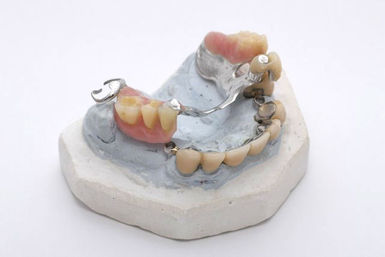 Eingliederung der Prothese Eingliederung der Prothese