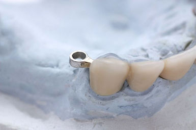 Ceka-Befestigungsselemente Ceka-Befestigungsselemente