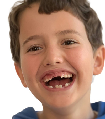 Kleine Z&auml;hne.  Gro&szlig;e Verantwortung.  Gute Begleitung.